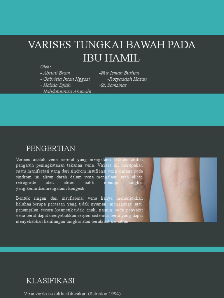 Penatalaksanaan FT Pada Varises Tungkai Bawah Ibu Hamil | PDF