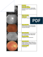 Banco de Preguntas Oftalmologia - Retina