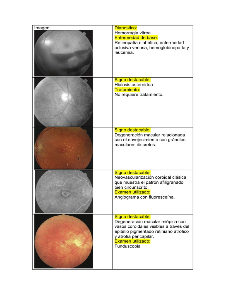 Funduscopia y Diagnósticos Retinianos | PDF | Medicina CLINICA ...