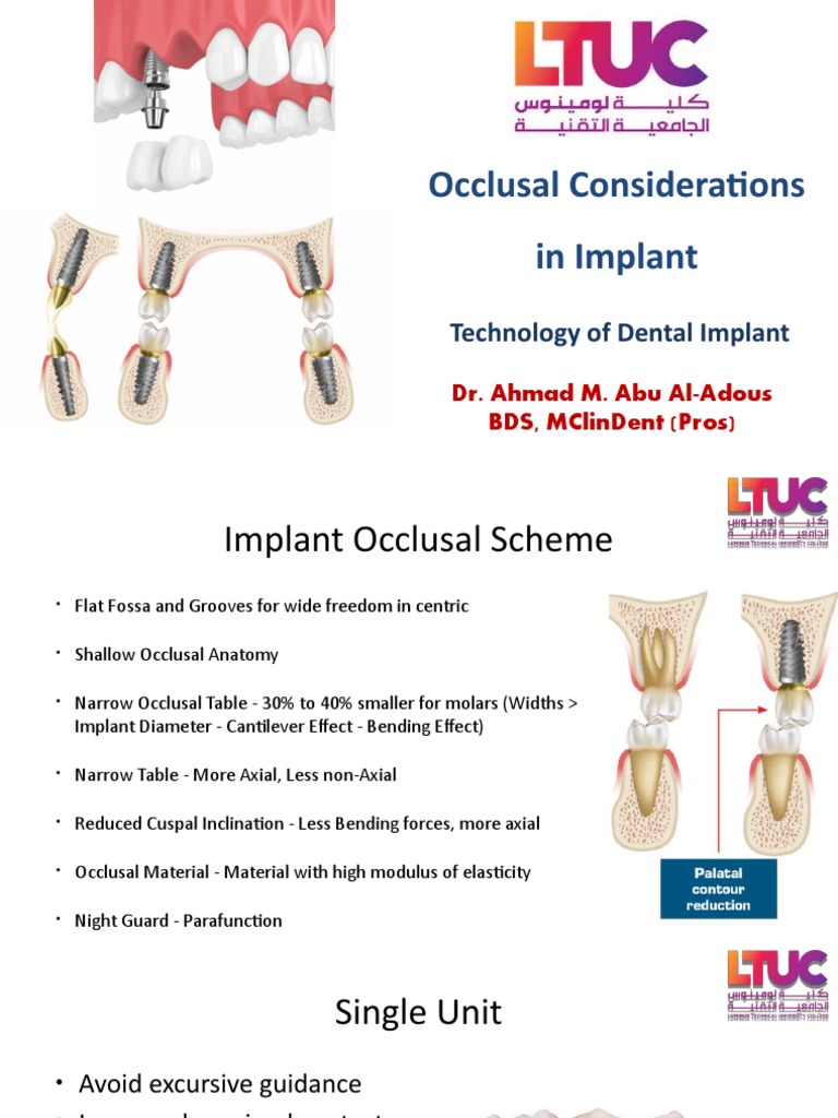 Occlusal Considerations in Implant Technology of Dental Implant PDF