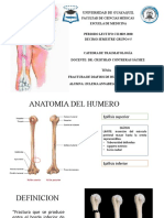 Fractura de Diafisis de Humero