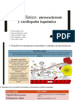 Caso Clínico Ateroesclerosis y Cardiopatía Isquémica-Fp