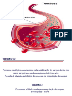 Trombose e Embolia - Causas, Tipos e Consequências