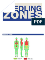 Needling Zones