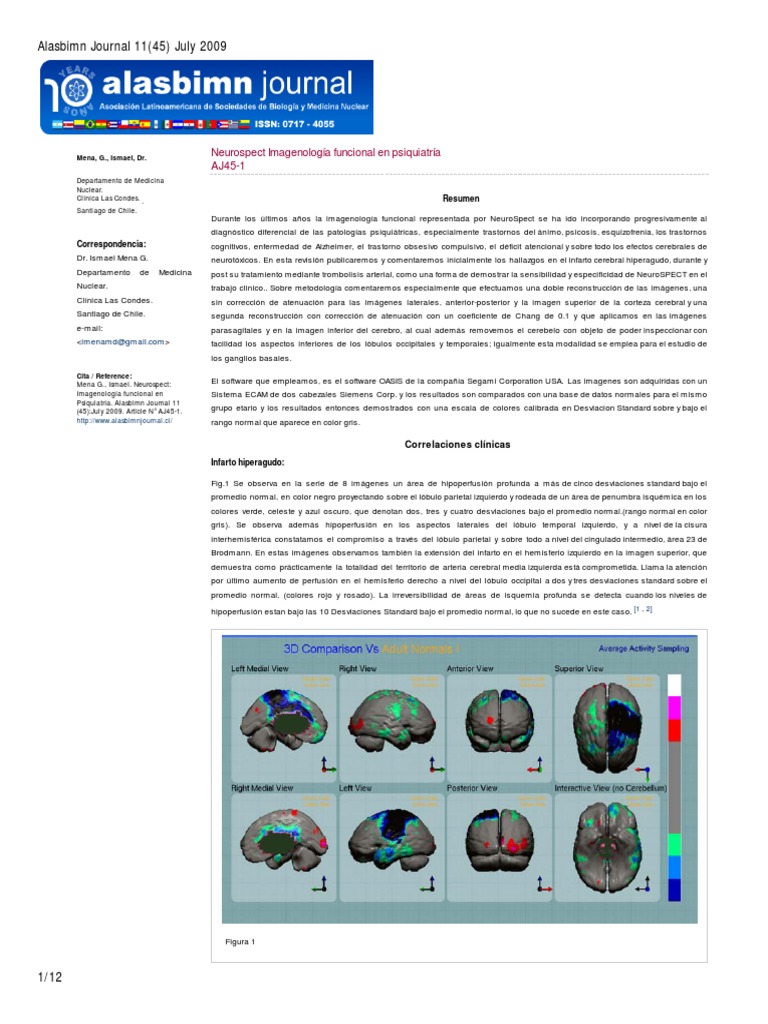 2009 MENA Neurospect Imagenologia Funcional en Psiquiatria | PDF ...