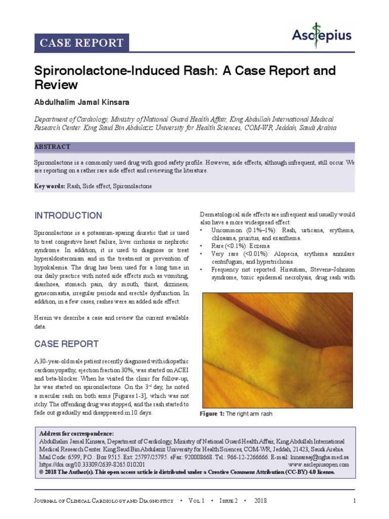Spironolactone-Induced Rash: A Case Report and Review | PDF | Diseases ...