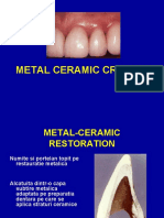 Metal Ceramic Restoration