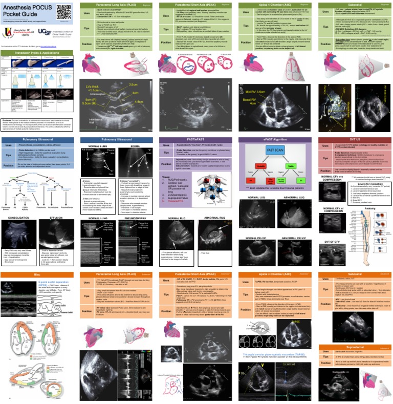 Anesthesia POCUS Pocket Guide | PDF | Lung | Medical Specialties
