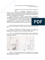 INTRODUÇÃO AO ESTUDO DA PRÓTESE PARCIAL FIXA