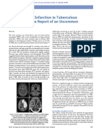 Large Cerebral Infarction in Tuberculous Meningitis: Case Report of An Uncommon Complication