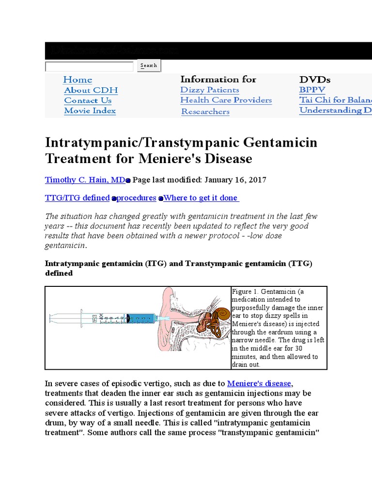Intratympanic/Transtympanic Gentamicin Treatment For Meniere's Disease