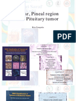 Pineal Sellar Pituitary Dr. Rita