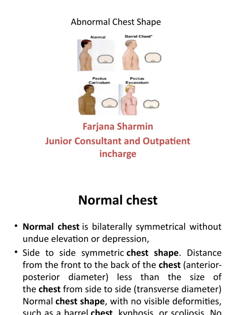 Abnormal Chest Shape: Farjana Sharmin Junior Consultant and Outpatient  Incharge