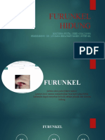 FURUNKEL HIDUNG - Maydina Gusta