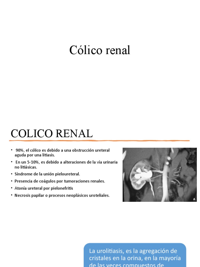 Cólico renal: causas y tratamiento | PDF | Especialidades Medicas ...