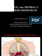 Ekg PPGD