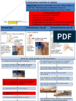 Guideline Intra Oseus