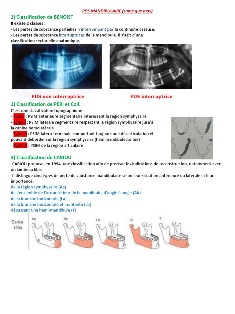 Classification des pertes de substance mandibulaire | PDF | Histoire