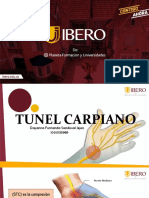 tunel carpiano