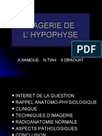 Imagerie de L'hypophyse