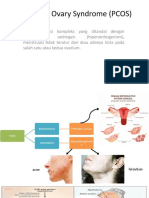 Polycystic Ovary Syndrome (PCOS)