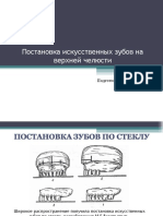 Правила постановки искусств. зубов на верхней челюсти