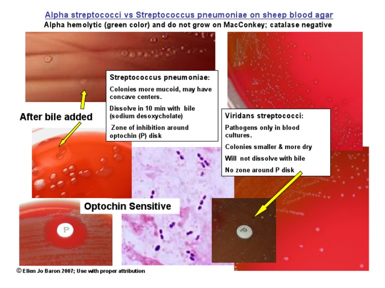 What Is Alpha Strep | Haemolysis of Streptococci and its types with ...