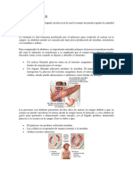 ENFERMEDADES