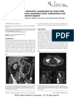 Type A Acute Aortic Dissection Complicated by Lower Limb Ischemia: Simultaneous Ascending Aortic Replacement and Femoro-Femoral Crossover Bypass