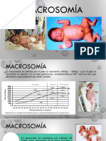 MACROSOMIA