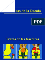 04 - Fracturas de La Rotula