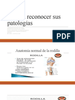 Rodilla reconocer sus patologias