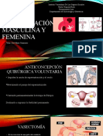 Esterilizacion Femenina