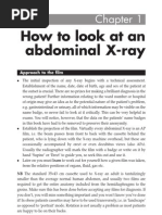 Download How to Read an Abdominal Xray by twentyjazzfunkgreats3055 SN55419647 doc pdf