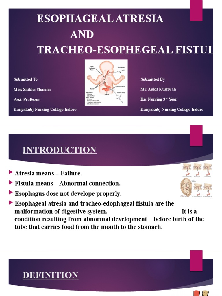 Esophageal Atresia | PDF | Esophagus | Medicine