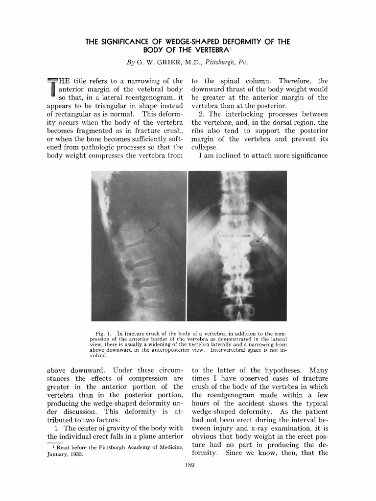 The Significance of WedgeShaped Deformity of The PDF Vertebra Vertebral Column