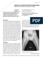 A Hip Resurfacing Implant in An Adolescent With Cerebral Palsy