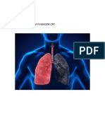 Pulmones de Um Fumador Cry