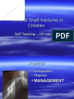 Femoral Shaft Fractures in Children