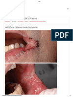Tema 11 - Caso Clinico - Topografia de Labio y Mucosa Yugal