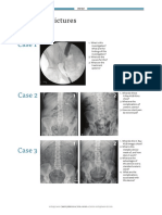 uromj14-spot-test-new