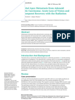 Crawford - 2017 - Orbital Apex Metastasis From Adenoid Cystic Carcinoma: Acute Loss of Vision and Subsequent Recovery With The Radiation