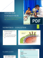 Síndrome Edematosos