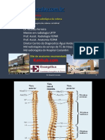 Anatomia Radiológica Coluna