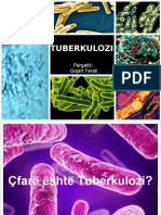 TUBERKULOZI