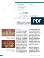 Gingival Recession - Causes and Management: Paul Baker