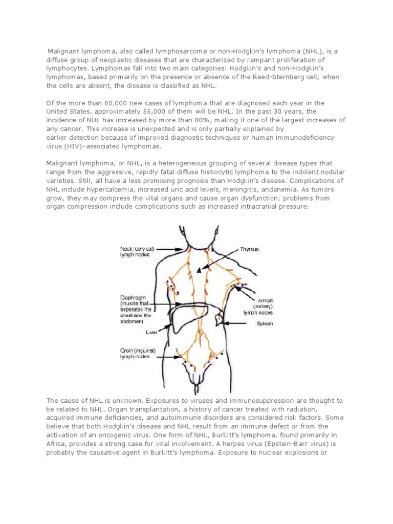 Malignant Lymphoma Lymphoma Clinical Medicine
