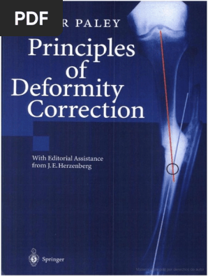 語学・辞書・学習参考書 principles of deformity correction Principles of Deformity Correction | PDF