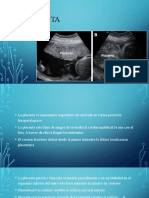 Presentacion Placenta