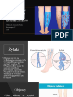 Programowanie Regabilitacji - Żylaki Gabriela Płotka